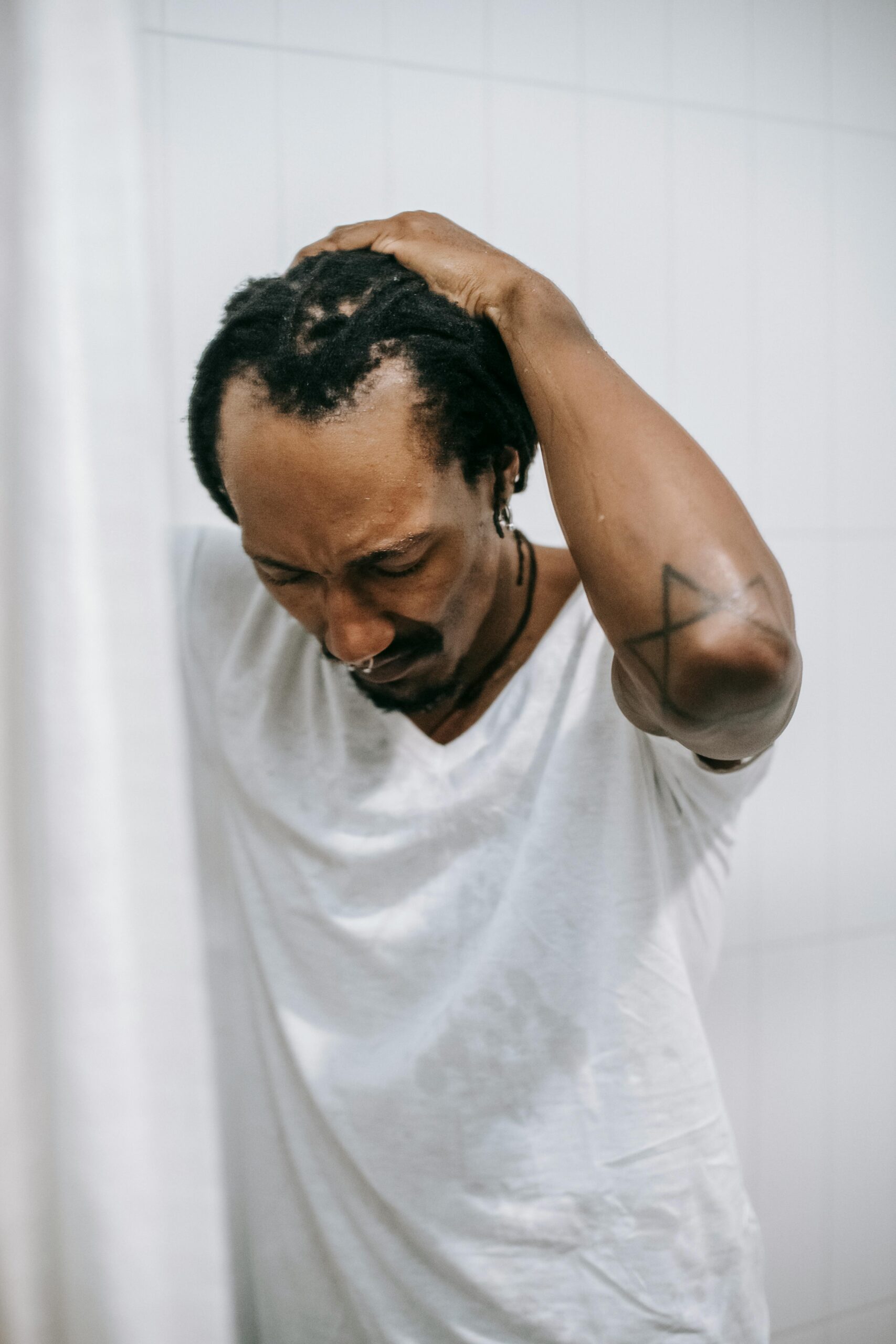 Queda de Cabelo Masculina: Causas, Tratamentos e o que Realmente Funciona